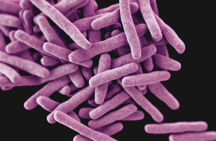 Tuberculosis cells: long, purple irregular cylinders